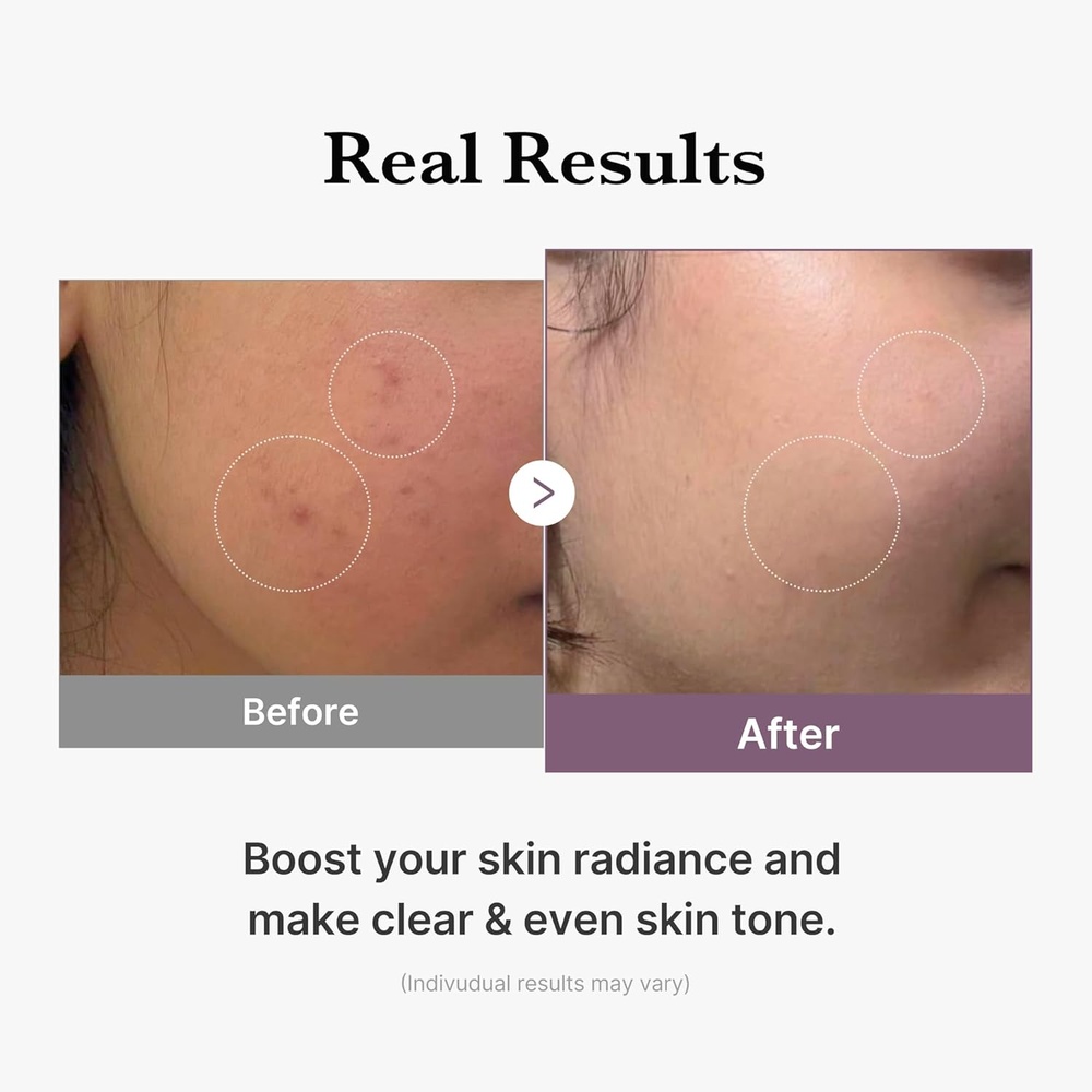 Medicube Age-R Glutathione Glow Toner 140ml Facial Toner